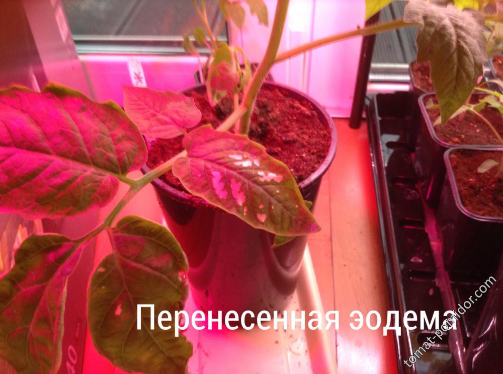 Следы перенесенной эдемы