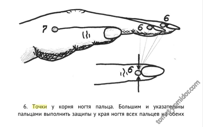 Эпилепсия